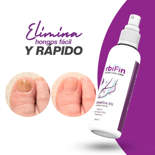 Terbifin